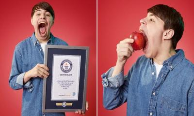 সবচেয়ে বড় হা করে বিশ্ব রেকর্ড মার্কিন তরুণের