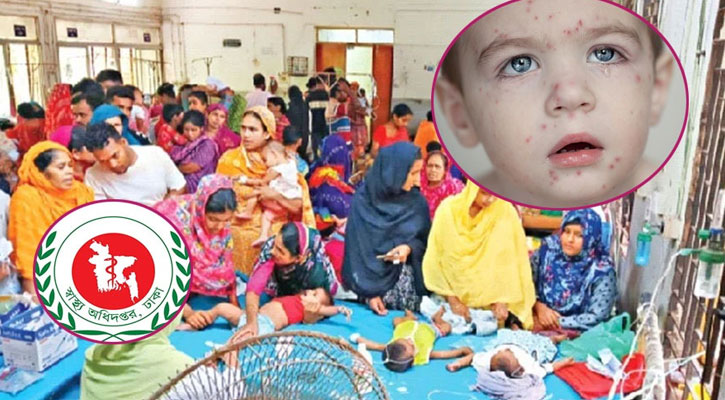 হামের উপসর্গ নিয়ে একদিনে ৯ শিশুর মৃত্যু, শনাক্ত ১১০৫