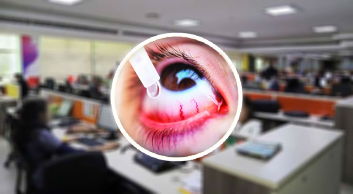 চোখ উঠলেই নিতে হবে ছুটি