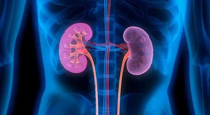এক বছরে কিডনি রোগীর সংখ্যা বেড়েছে তিনগুণ 