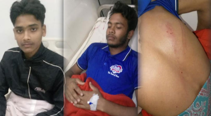 ইন্দুরকানীতে ছাত্রলীগের হামলায় শিবিরের ৩ কর্মী আহত
