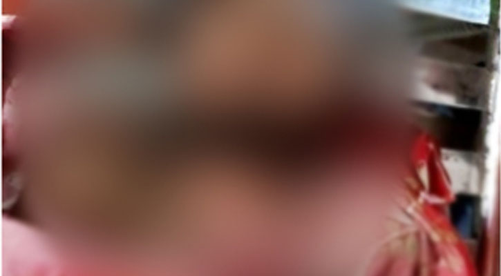 ৯ মাস পর মৃত্যু হলো জুলাই আন্দোলনে গুলিবিদ্ধ কিশোরের