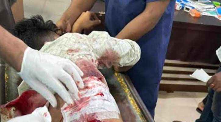 রূপগঞ্জে রাজনৈতিক কোন্দলে ফার্মেসিতে গুলিবর্ষণ, গার্মেন্টস শ্রমিক গুলিবিদ্ধ