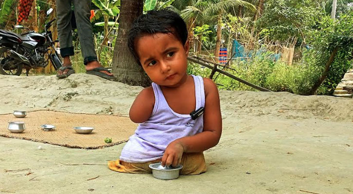 বেঁচে থাকতে চায় হাত-পা হীন প্রতিবন্ধী সুলতানা 