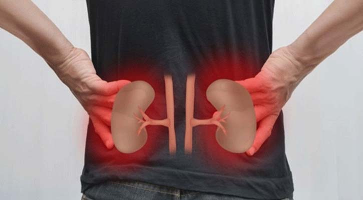 যেসব কারণে কিডনি নষ্ট হতে পারে, ভালো রাখায় ৫ উপায়