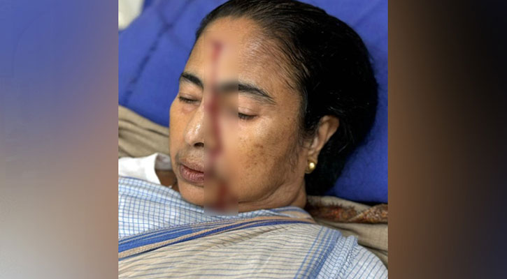 পা পিছলে গুরুতর আঘাত পেলেন মমতা