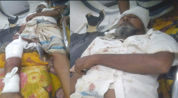 যুবলীগ নেতার হামলায় বিএনপির ১০ কর্মী আহত