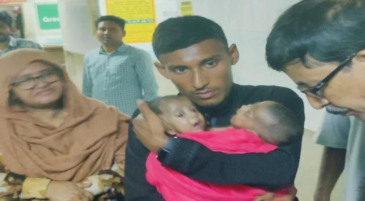 জোড়া লাগা দুই শিশুর চিকিৎসার দায়িত্ব নিল সরকার