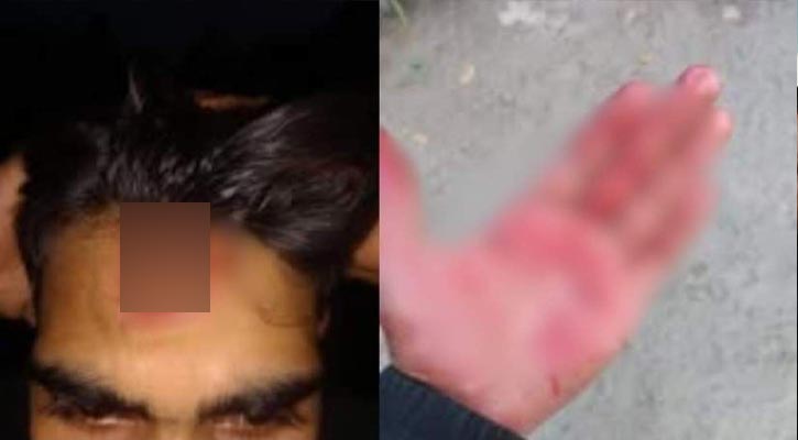 মাইকে ঘোষণা দিয়ে এনসিপি নেতাকর্মীদের ওপর হামলা ও বাড়িঘরে ভাঙচুরের অভিযোগ