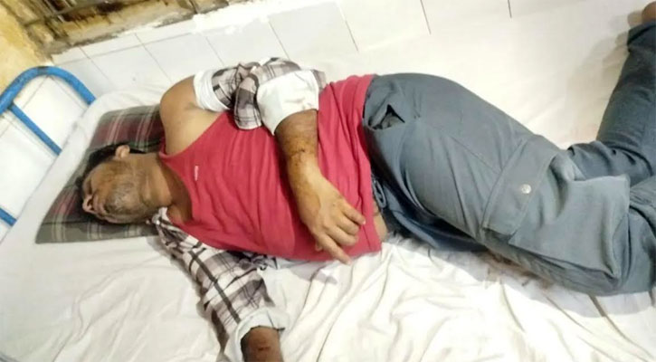 কর্মস্থলে দেরিতে আসায় কর্মচারীকে লোহার পাইপ দিয়ে পিটুনি