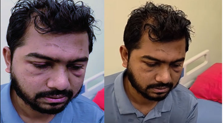 নুরের শর্ট মেমোরি লস হয়নি : ঢামেক পরিচালক