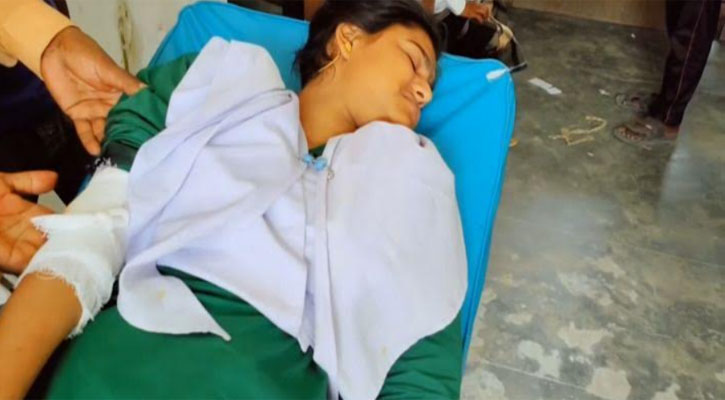 ইউএনও’র হস্তক্ষেপে পরীক্ষায় বসছে হাত ভাঙা সেই এসএসসি পরীক্ষার্থী 